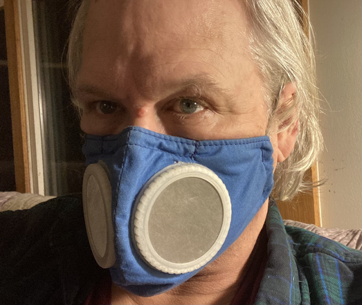A blue fabric mask on my face with the 60mm diameter 3D printed filter holders. The outer stainless steel mesh surface of the 3-layer SS mesh, MIRV-16 filter fabric, SS mesh layer is visible in both of the 60mm filter holders.